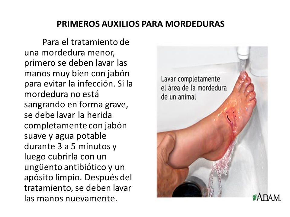 La lista de los alérgenos a atopicheskom la dermatitis